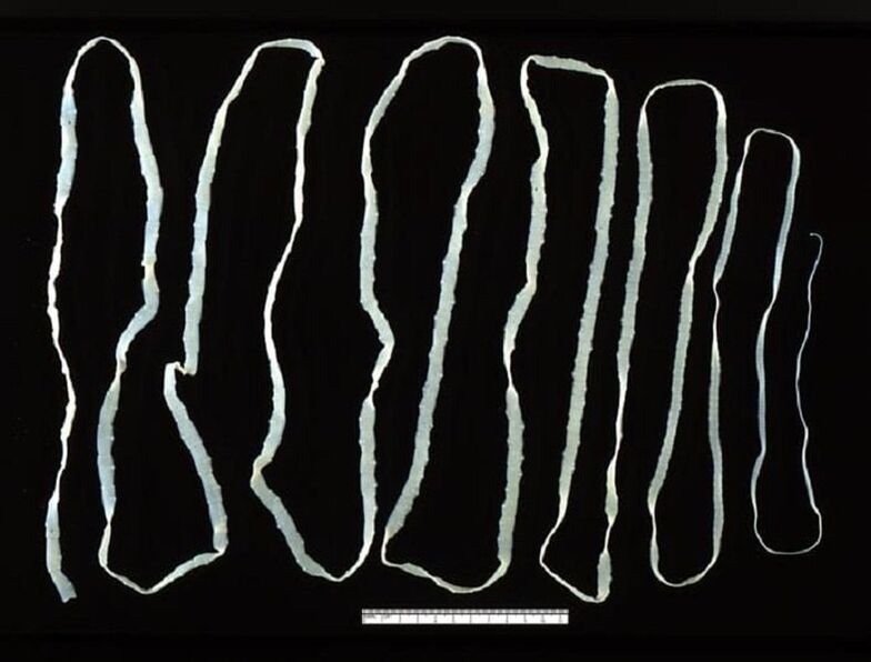 Tape extracted from the human intestine