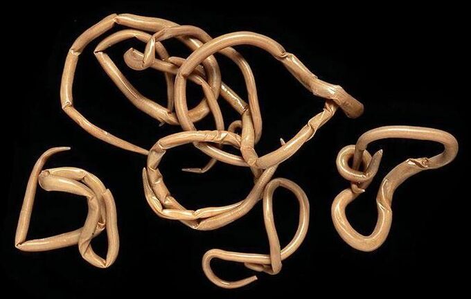 roundworms on the body
