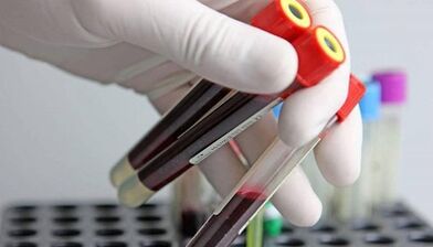 How to do tests for pests in the body