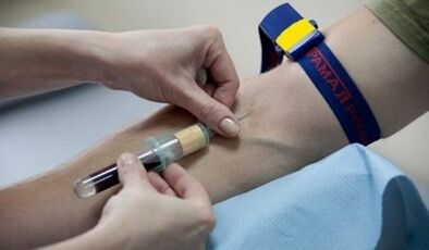 How to prepare for pests testing