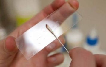 Which tests should be taken for pests