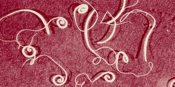 photo of human parasites