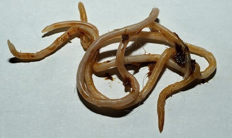 archer from the human body